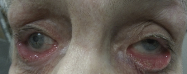 Ivermectin Fp 3mg