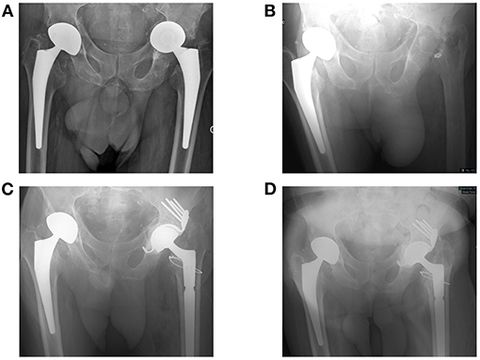 Implant antabuse france