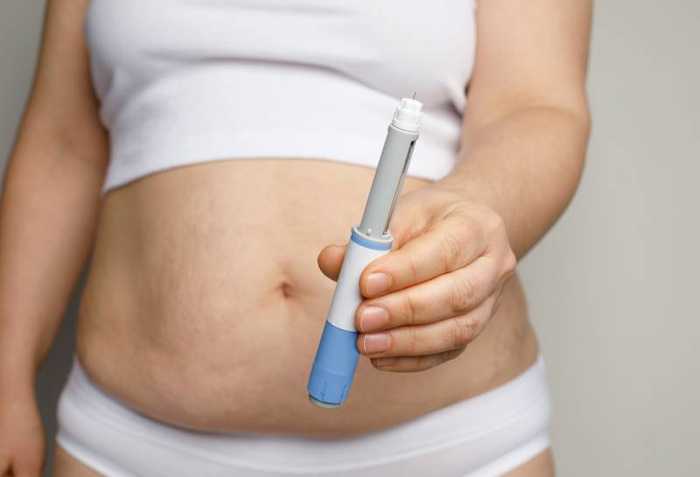 Acheter Phentermine