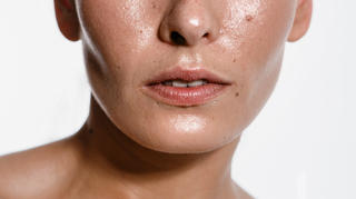 Roaccutane pilules