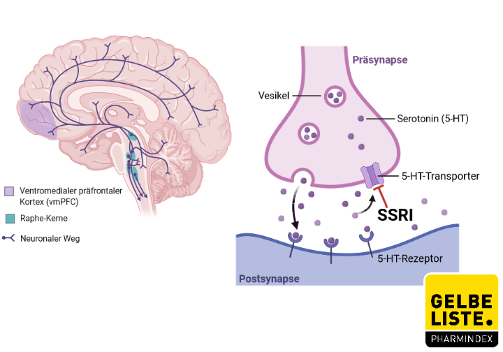 Sertraline zentiva 25 mg