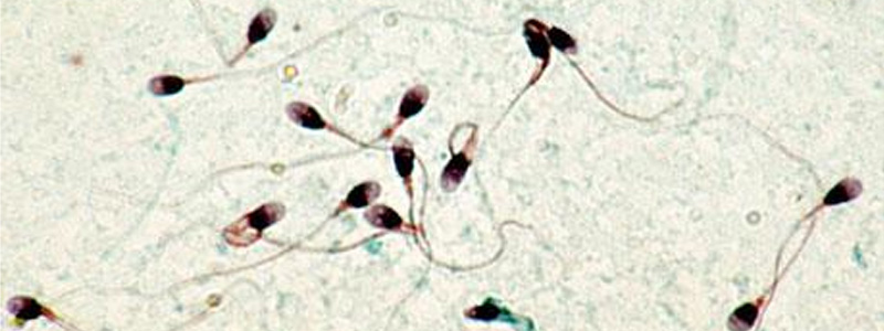 Acheter du clomiphene en ligne