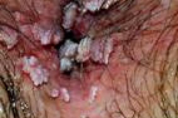 Aldara en ligne