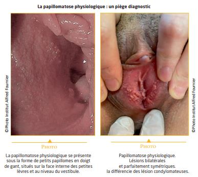 Aldara medicament prix