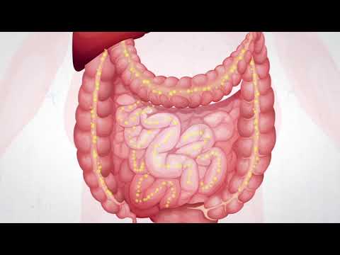 Alli® générique (orlistat) 60 mg