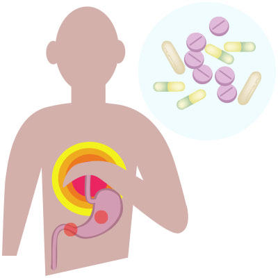Alprazolam Generique De Quel Médicament