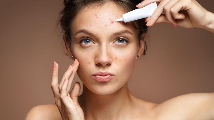 Pilule sous roaccutane