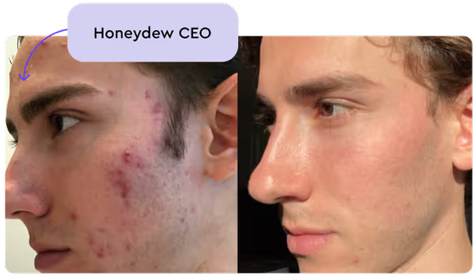 Commander du accutane en ligne