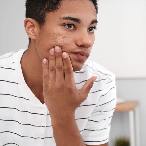 Prix de roaccutane