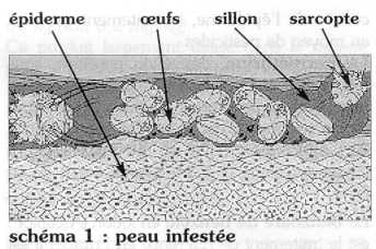 ivermectine sans ordonnance belgique