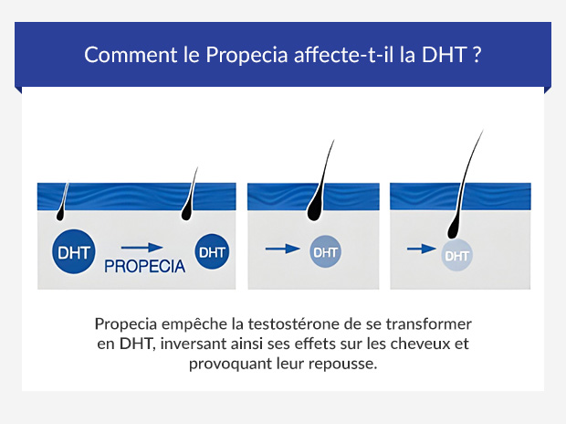 Achat propecia en ligne