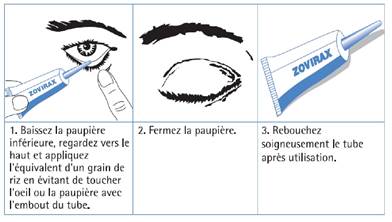 Acheter zovirax sans ordonnance