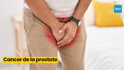 Chibro proscar prix