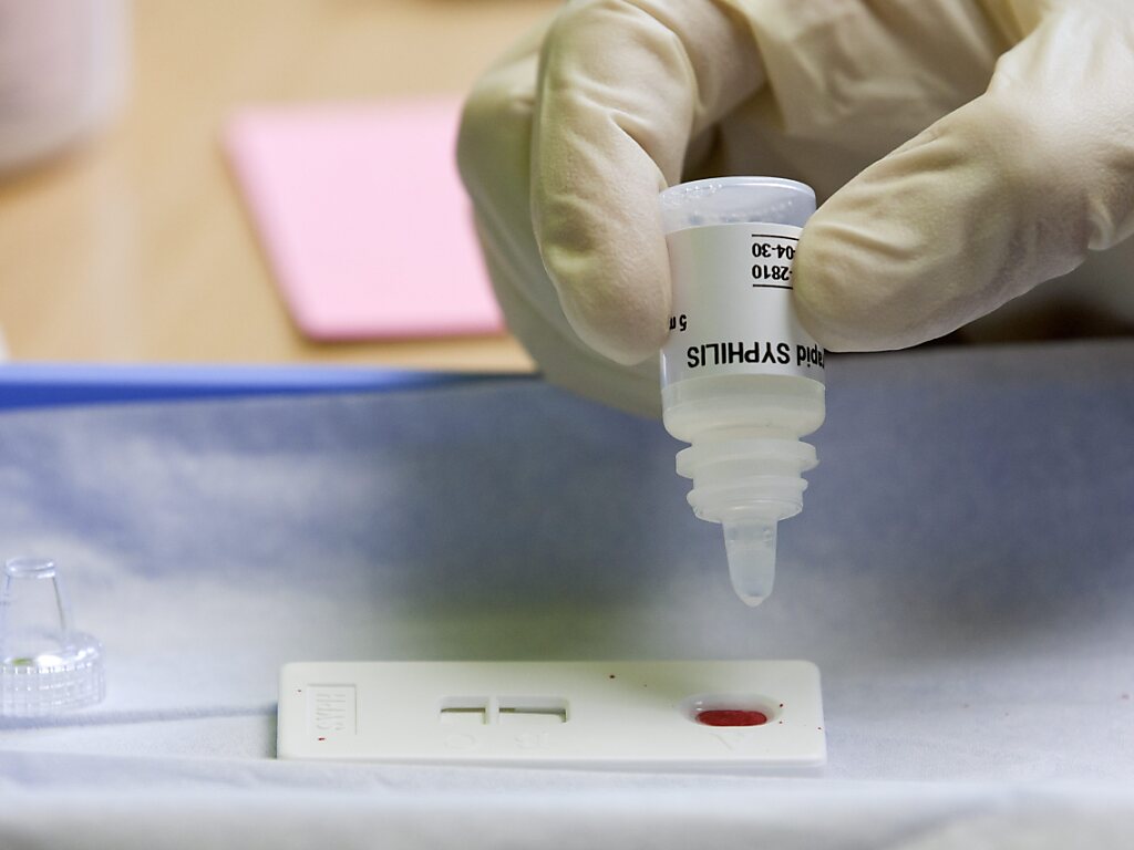 Comment acheter du doxycycline