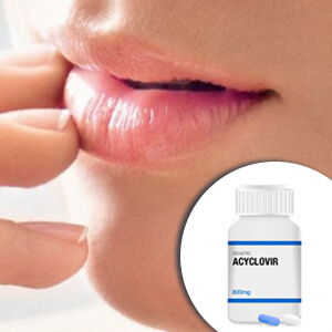 Aciclovir achat
