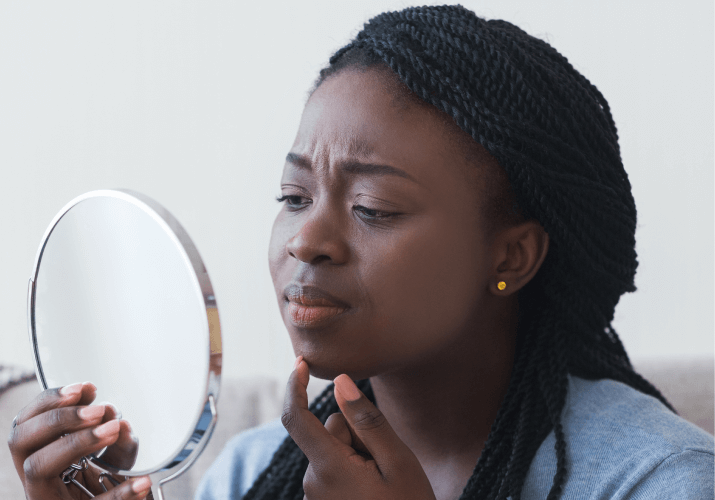 Roaccutane ordonnance en ligne