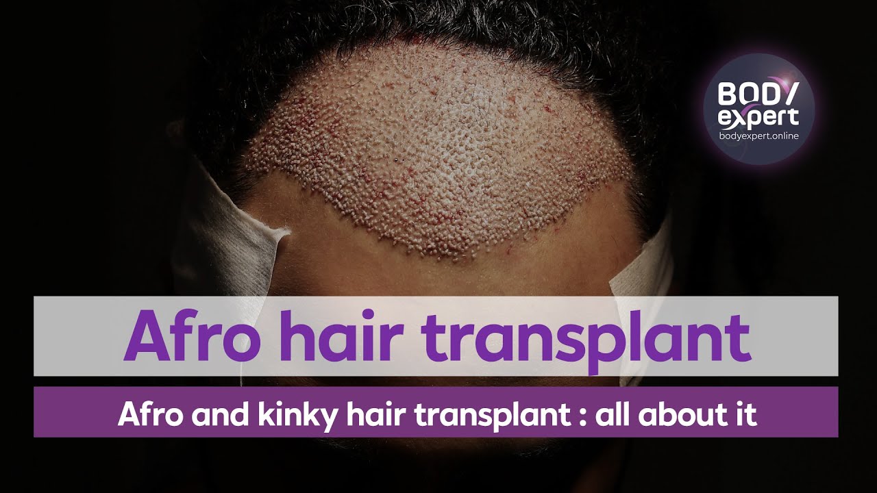 Finasteride propecia online
