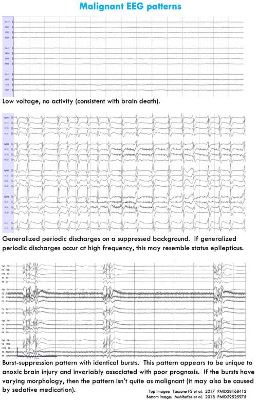 Ativan en ligne