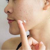 Interdiction Accutane France