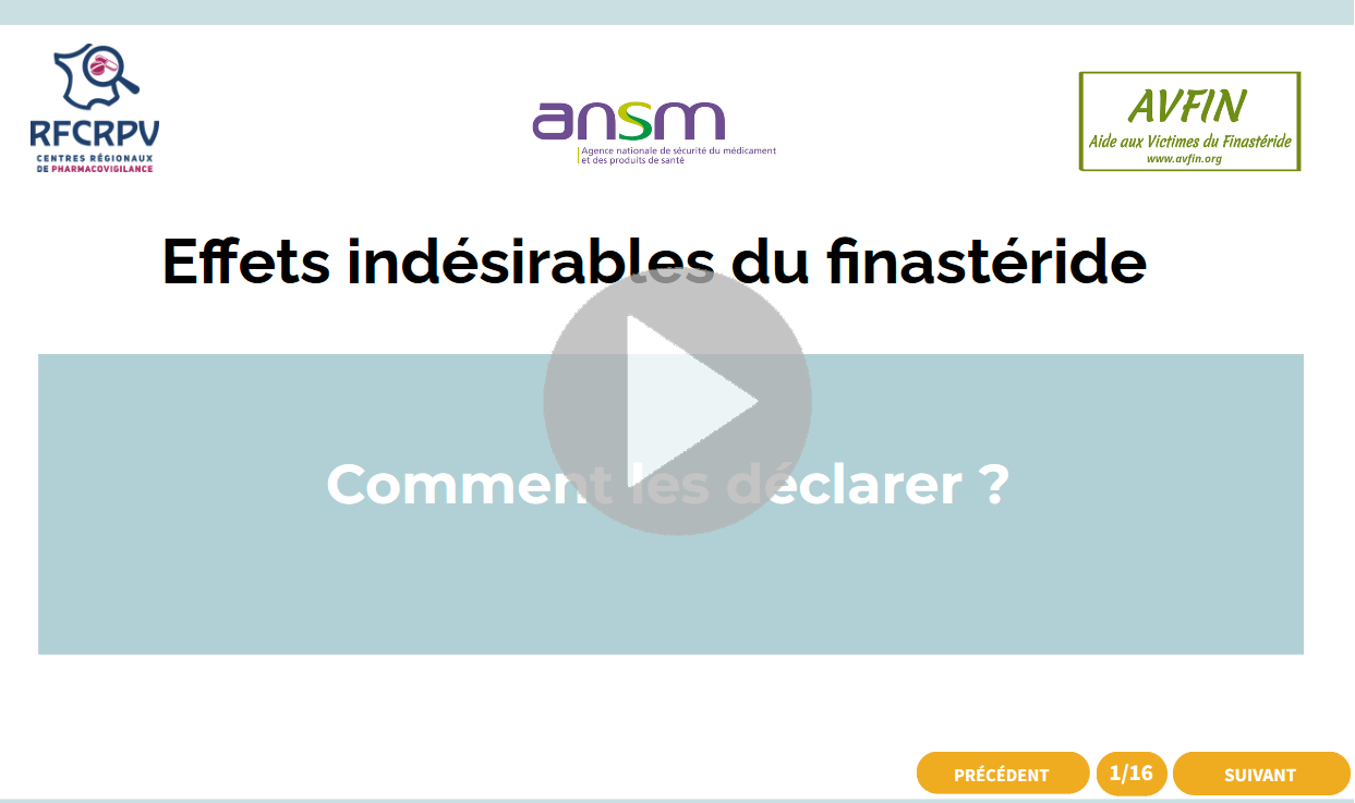 Finasteride 5mg online