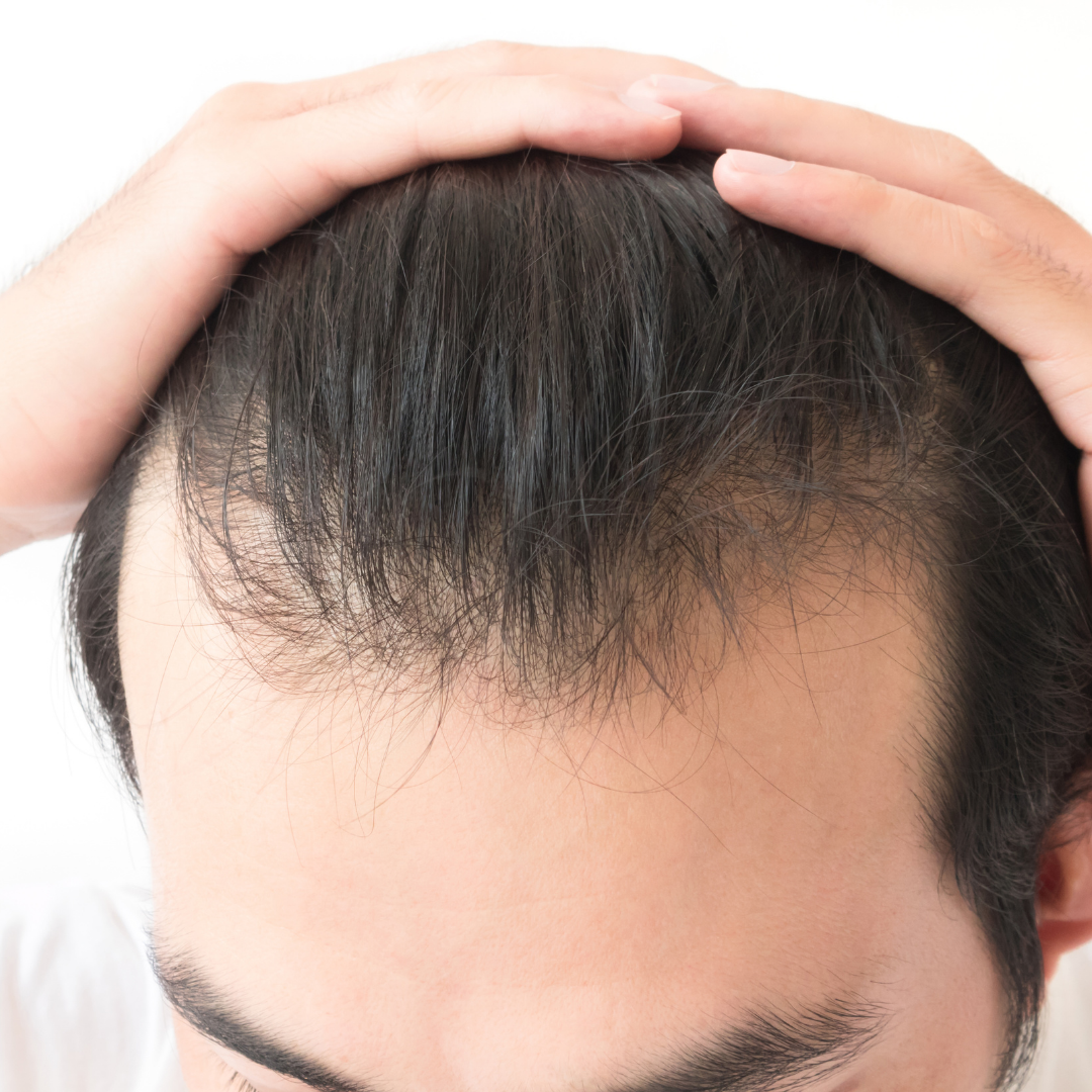 finasteride bon marché