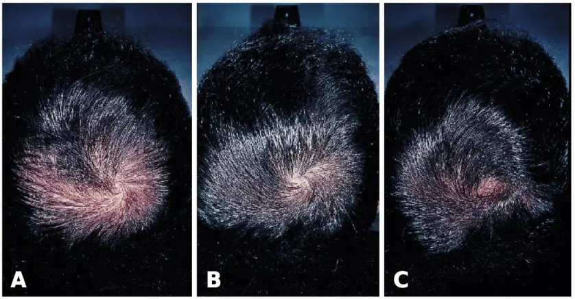 Finasteride générique