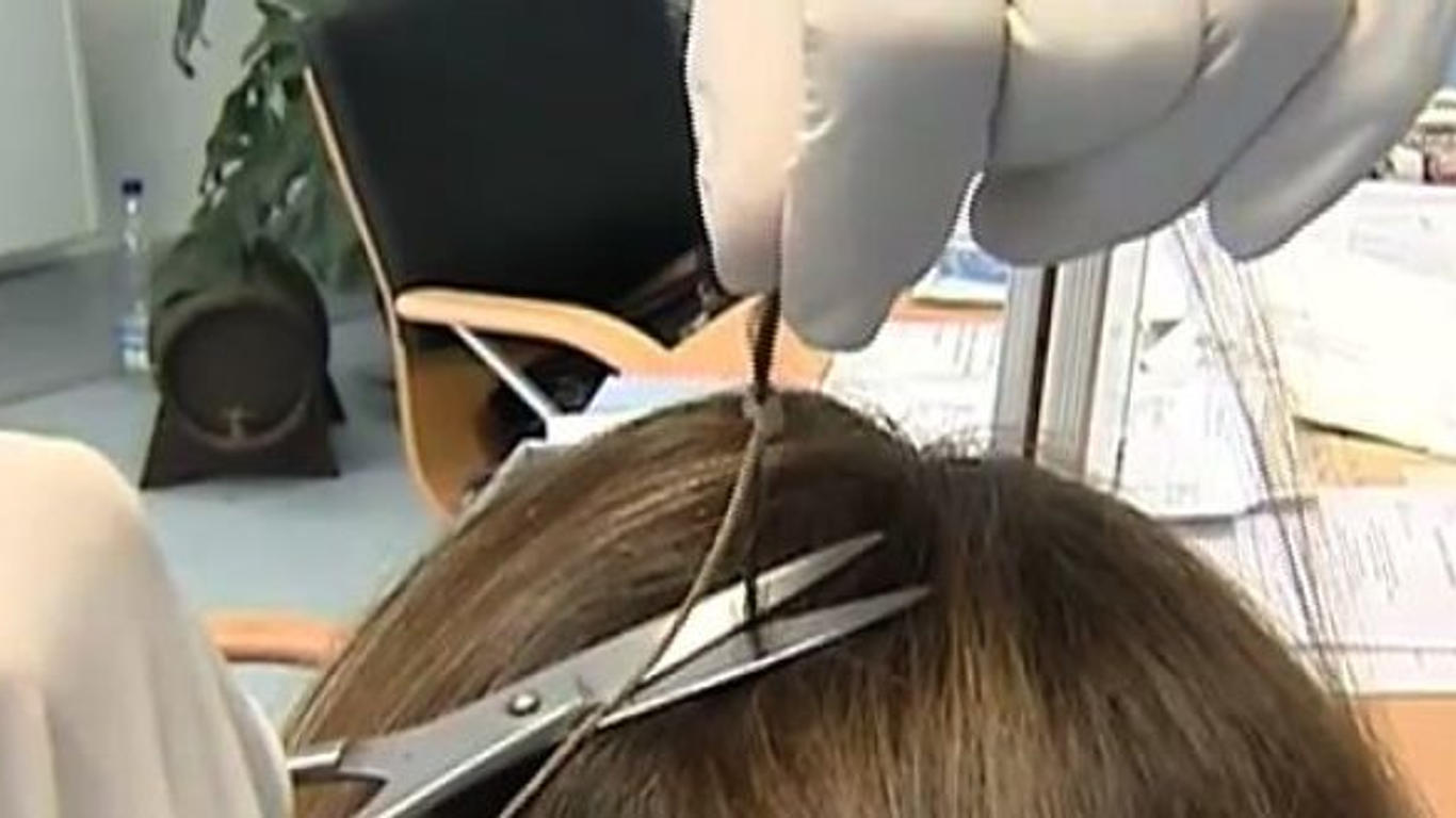 Finasteride moins cher