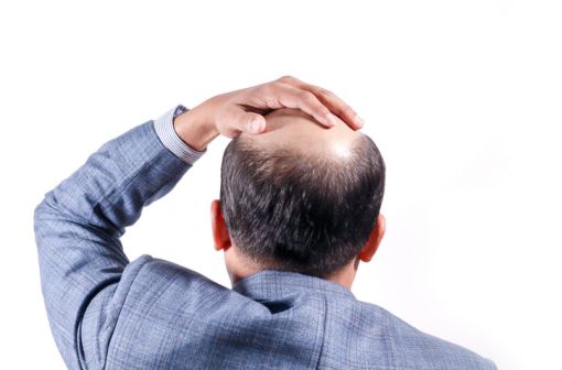 Finastéride Acheter Sans Ordonnance
