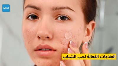 fluconazole prix tunis