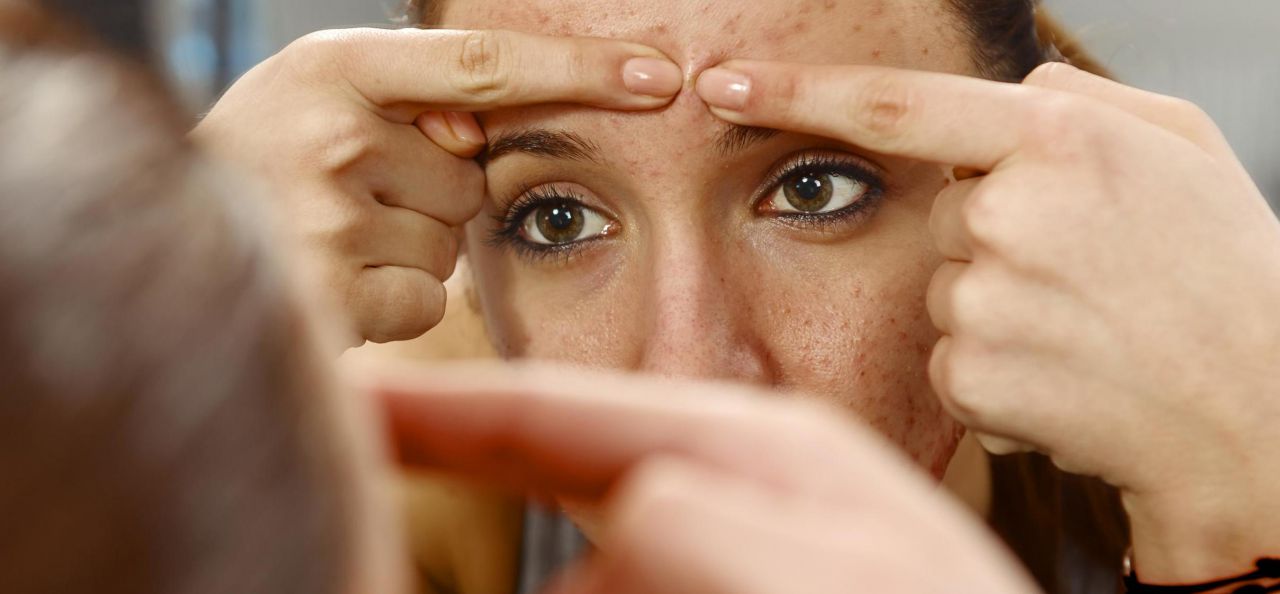 Interdiction accutane france