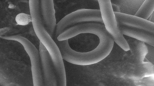 Ivermectin pilule