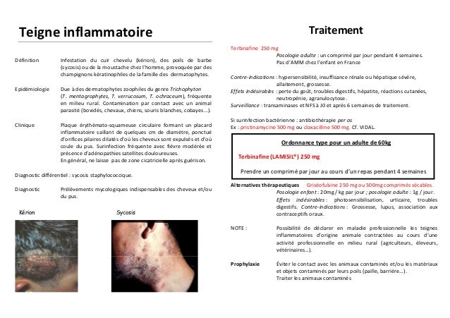Ivermectine crème sans ordonnance