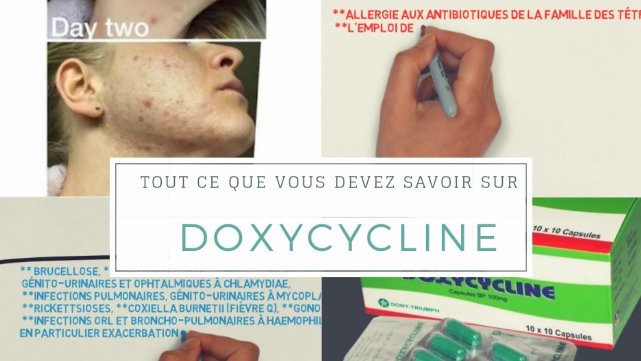 le prix du doxycycline