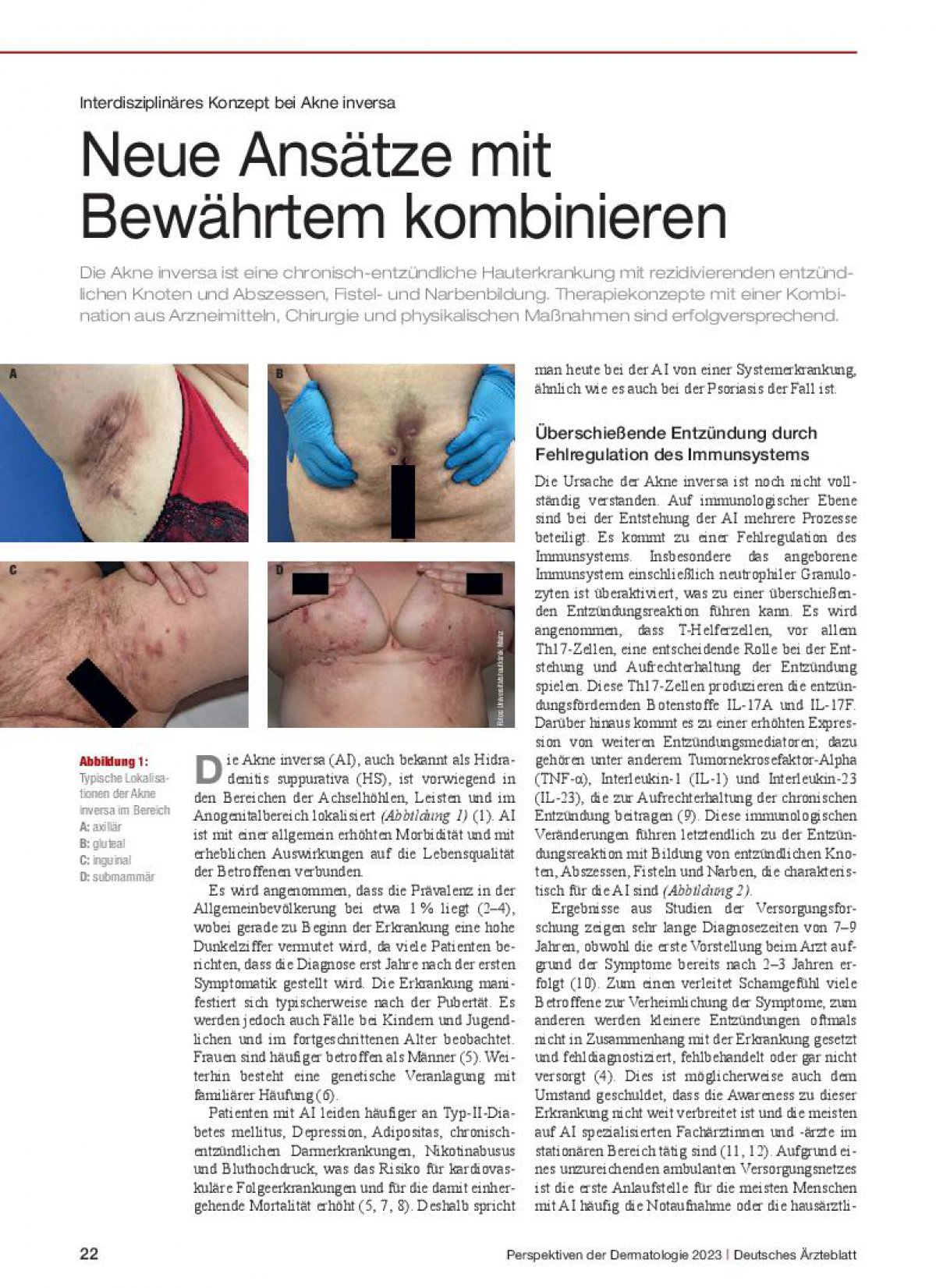 Online dermatologist isotretinoin