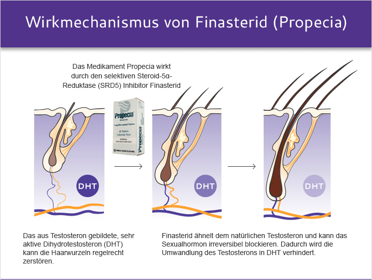 propecia finasteride online