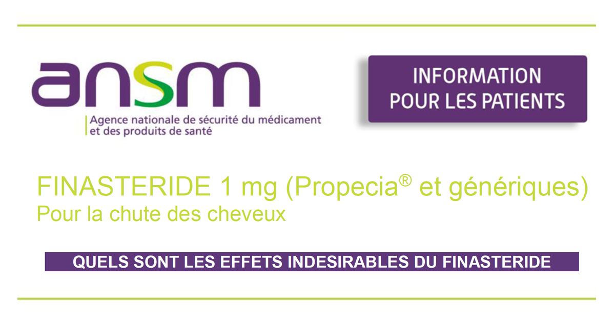 Proscar 1mg online