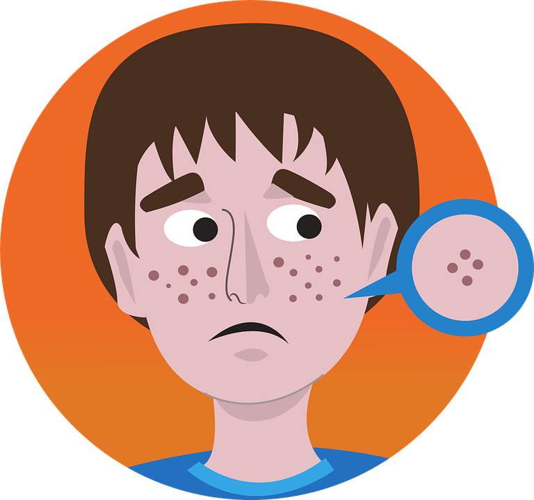 Roaccutane achat france