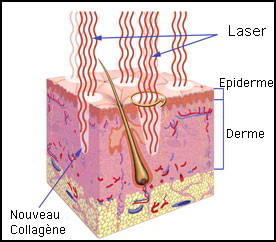 Roaccutane Gel Prix Remboursement