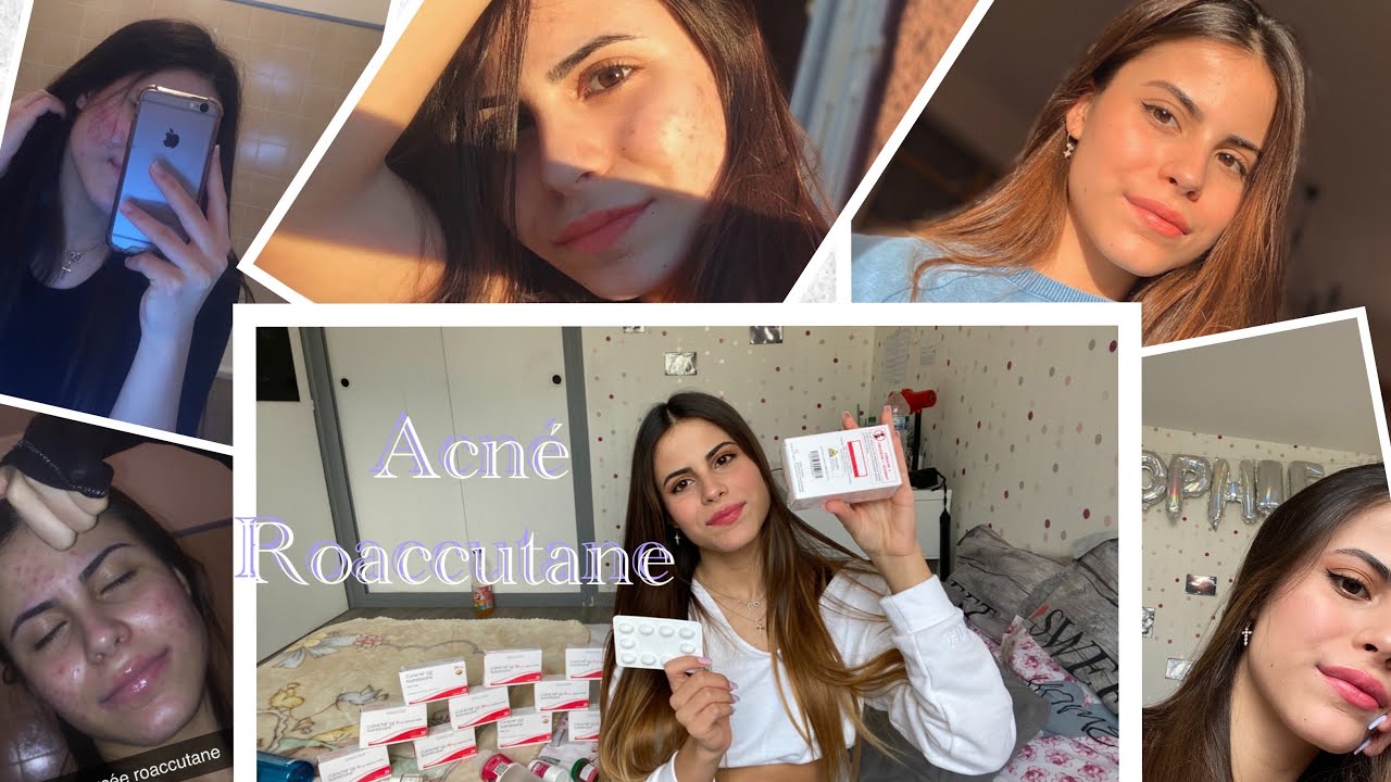 Roaccutane le moins cher