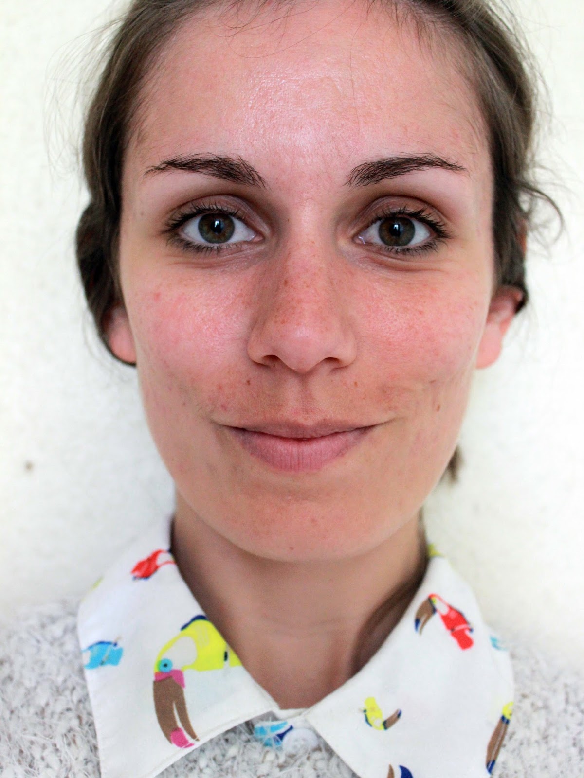 Roaccutane ou pilule