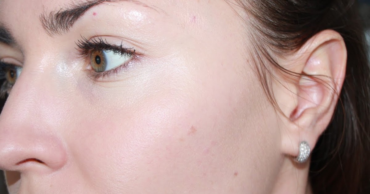 Roaccutane pas cher