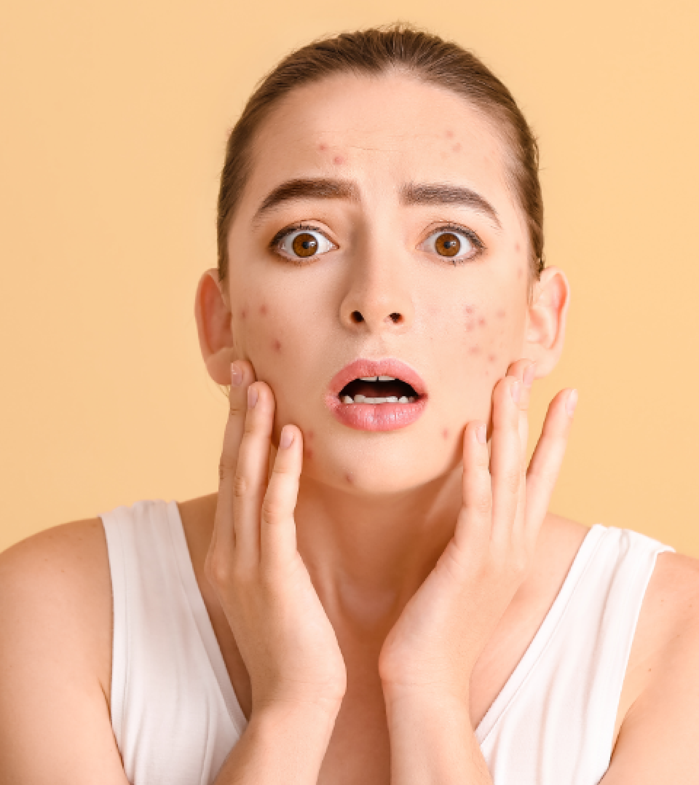 Roaccutane Quelle Pilule