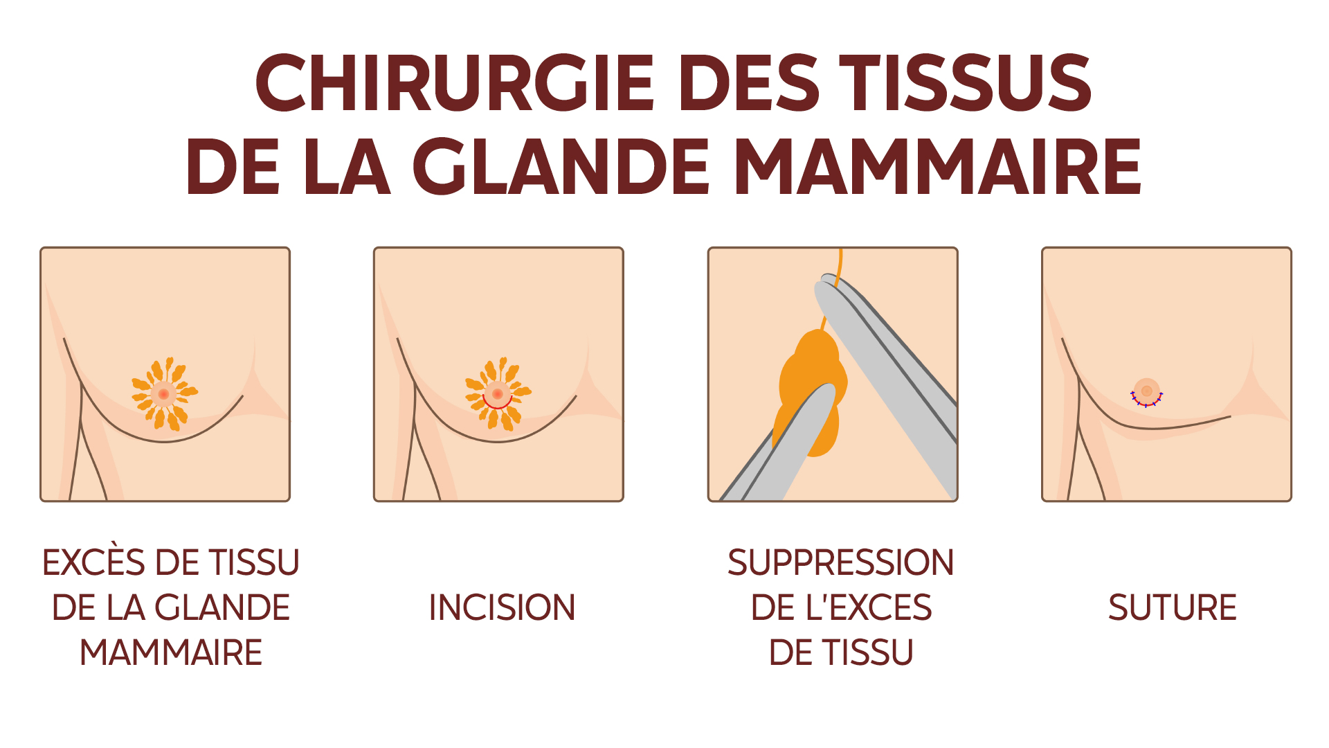 Tamoxifen Prix France